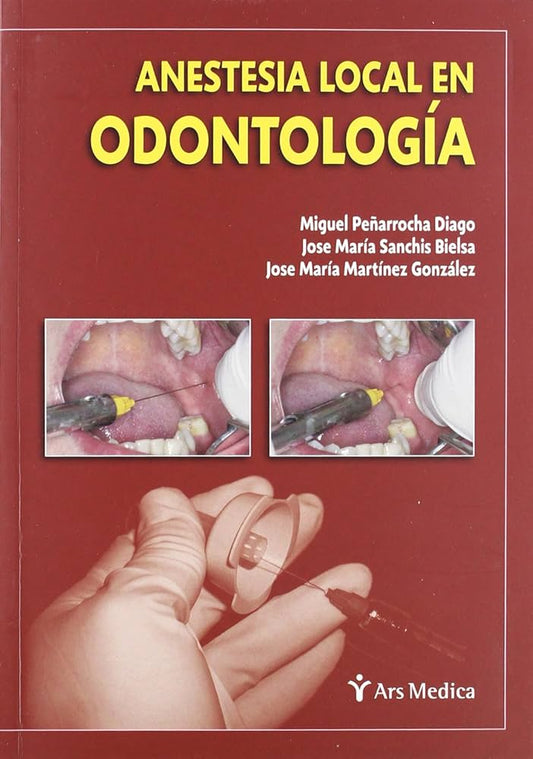 Anestesia local en odontología - Peñarrocha y otros