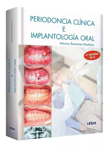 Periodoncia clínica e implantología oral - Antonio Bascones Martínez